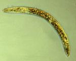 Ring Nematode
